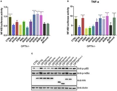 ALS-Associated E478G Mutation in Human OPTN (Optineurin) Promotes Inflammation and Induces Neuronal Cell Death